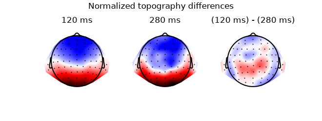 Normalized topography differences, 120 ms, 280 ms, (120 ms) - (280 ms)