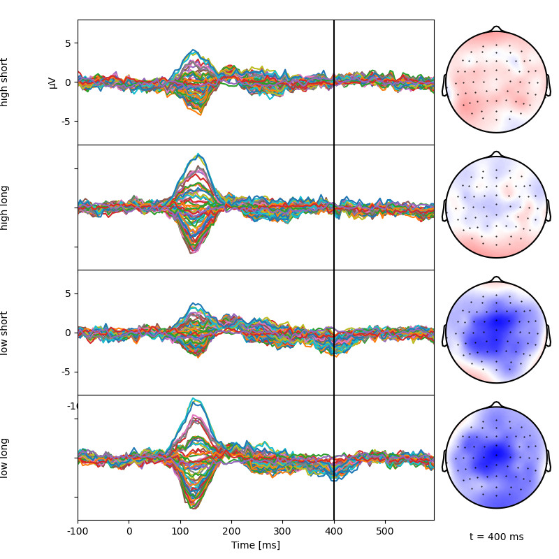 sensor anova